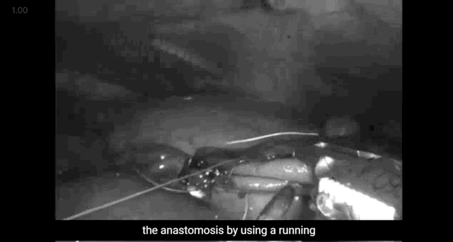 51531644361585750